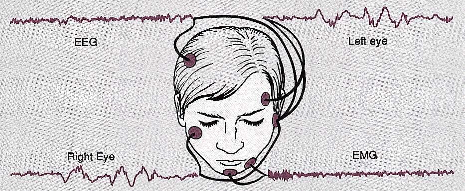 Measuring REM in sleep