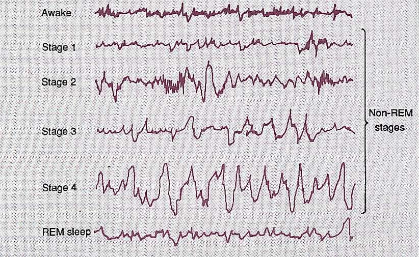 REM and sleep stages
