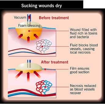 New Scientist. Science news and long reads from expert journalists, covering developments in science, technology, health and the environment on the website and the magazine.