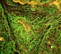 Photo&colon; Anya Salih