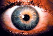 Eye-opening success for iris scans