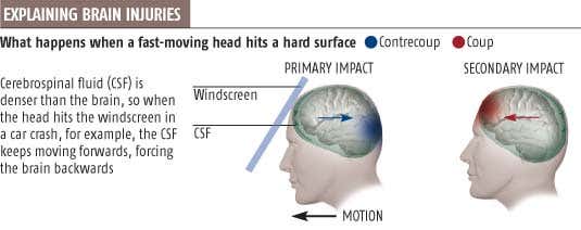 Head injuries' double whammy explained