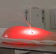 Optic fibre delivers solar surgery