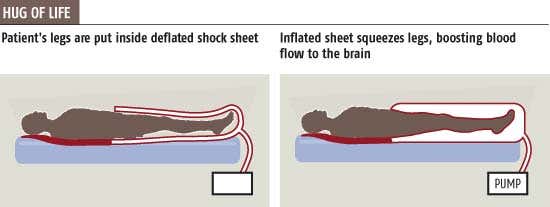 'Shock sheet' squeezes blood to dying brain