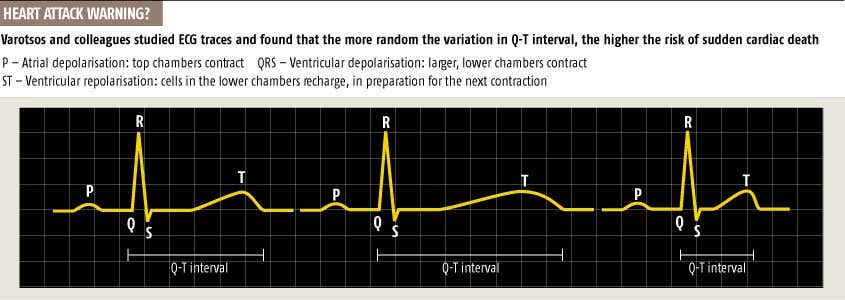 Heartbeats warn of sudden death risk