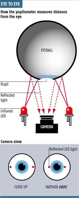 Crash victims' head injuries spotted by 'pupilometer'