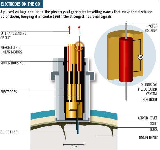 Moving brain implant seeks out signals