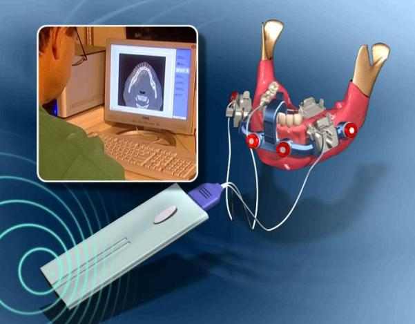 'Robotic' dental drill to be tested on humans