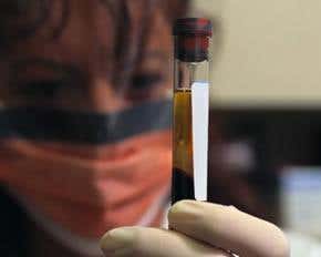 Flu pandemic: Lethal yet preventable