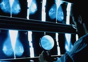 Pop star's cancer prompts surge in screenings