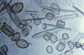 Looking for LUCA – the mother of all life