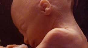 Abortion: Science, politics and morality collide