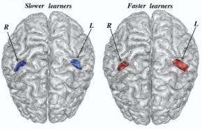 Fast language learners boast more white matter