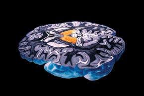 Interview: Confessions of a brain surgeon