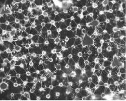 Researchers say the cell networks could be used in novel biosensors (Images:Yael Hanein)