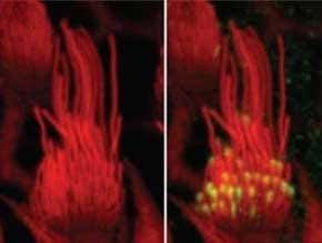 Discovery of key protein may help prevent hearing loss