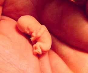 Sobering news for pregnant women