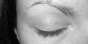 Regaining consciousness: A life or death dilemma