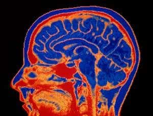 Introduction: The Human Brain