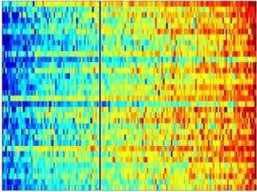 Gene profiling boosts tailored chemotherapy