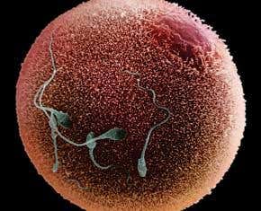 Reproduction revolution: The egg and sperm race