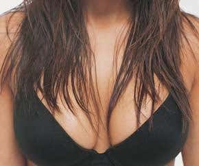 Cosmetic surgery special: When looks can kill