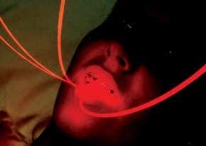 Could surgeons use headlights in place of lasers?