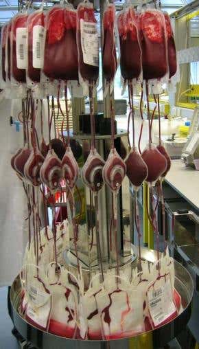 Filter removes mad cow proteins from blood