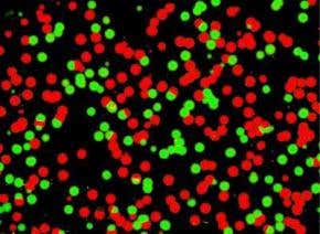 Drug-resistant HIV battled in a new way