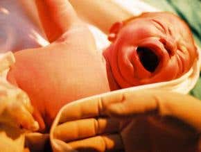 Extreme childbirth: Freebirthing