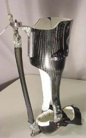 Walkers take artificial ankle in their stride