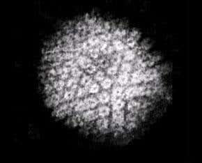 Herpes drug helps control HIV