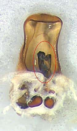 'Chastity belts' block rival sperm in female spiders