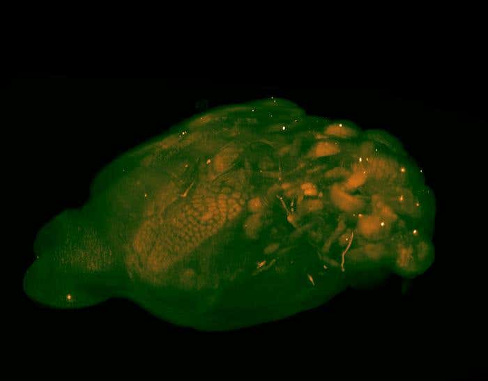 A whole mouse brain showing individual neurons fluorescing