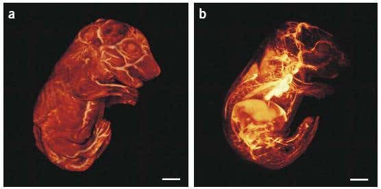 How to make a brain transparent