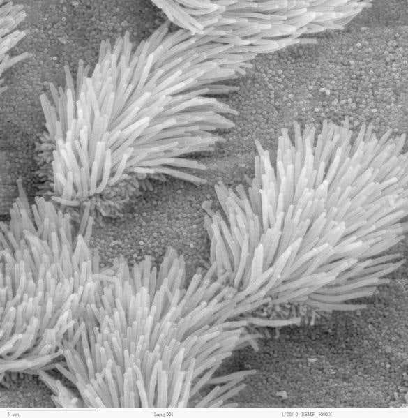 Scanning electron microscope image of lung cilia