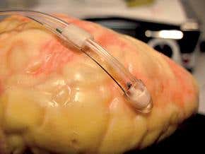 Creepy-crawly robot to mend a broken heart