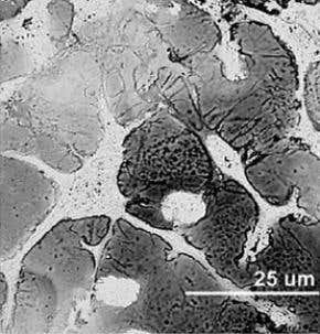 Moulded connections could improve brain implants