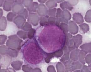 New mouse stem cell is just like ours