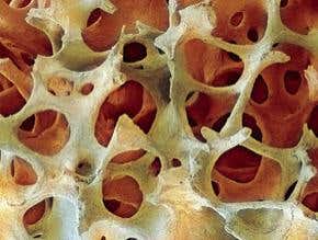 Unbreakable: the tough secrets of nature's glue