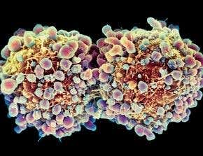 Nanospheres leave cancer no place to hide