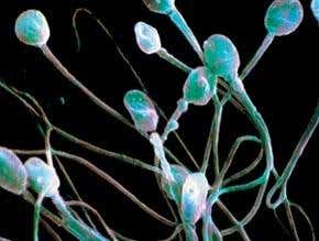 Weeding out the bad sperm from the good