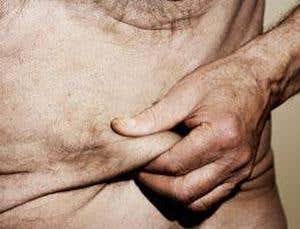 Evolution's greatest mistakes