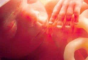 As good as new: Scarless healing