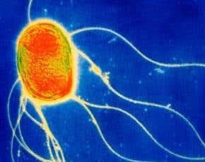 Superbugs: Scare in the community