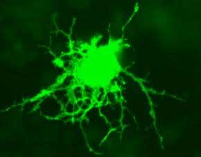 Nanoparticle lights up at the site of cancer