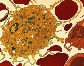 Reprogrammed immune system fights cancer