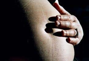 Dietary supplement may boost egg yield for IVF