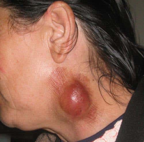 Were 'cursed' rams the first biological weapons?