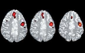 Mapping brain could translate thoughts into speech